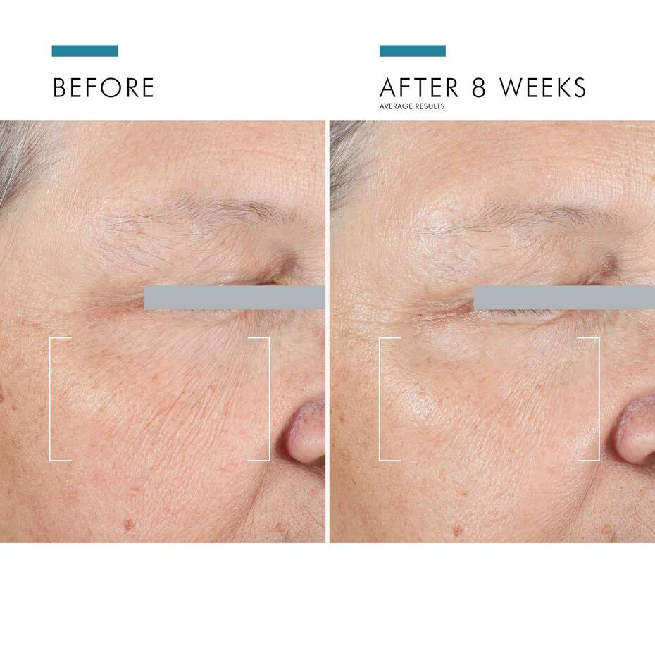 SKINCEUTICALS A.G.E. ADVANCED EYE FOR DARK CIRCLES