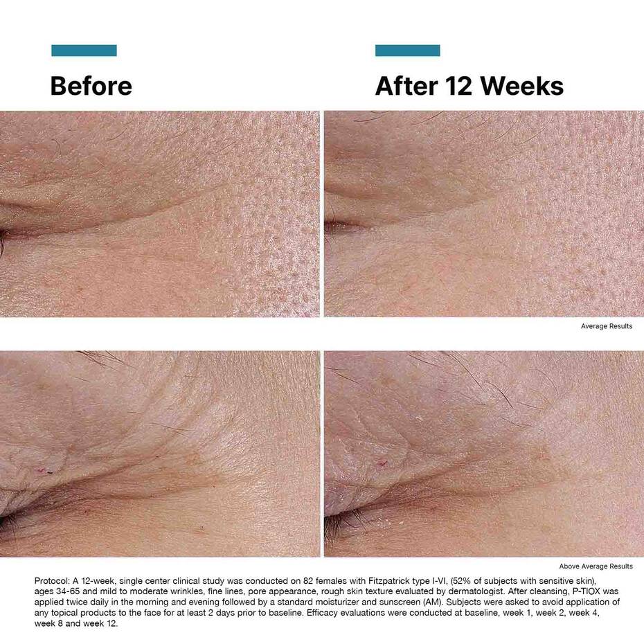 SKINCEUTICALS P-TIOX SERUM
