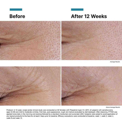 SKINCEUTICALS P-TIOX SERUM