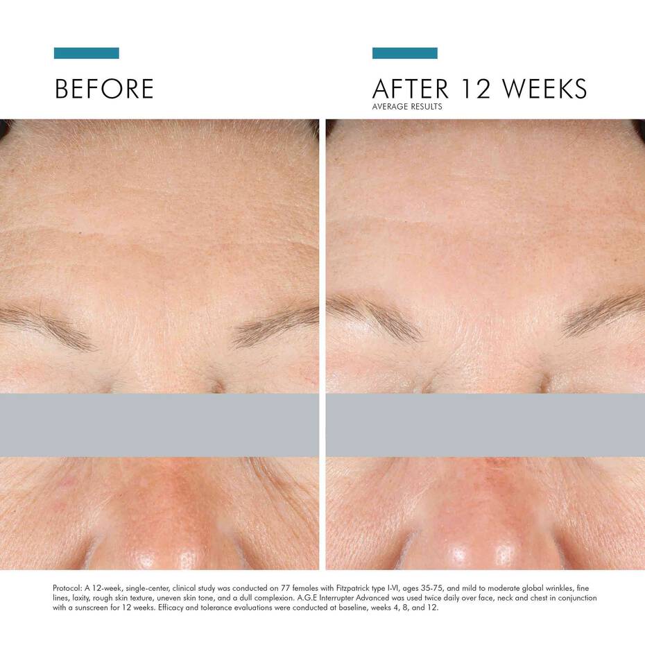 SKINCEUTICALS A.G.E. INTERRUPTER ADVANCED CREAM