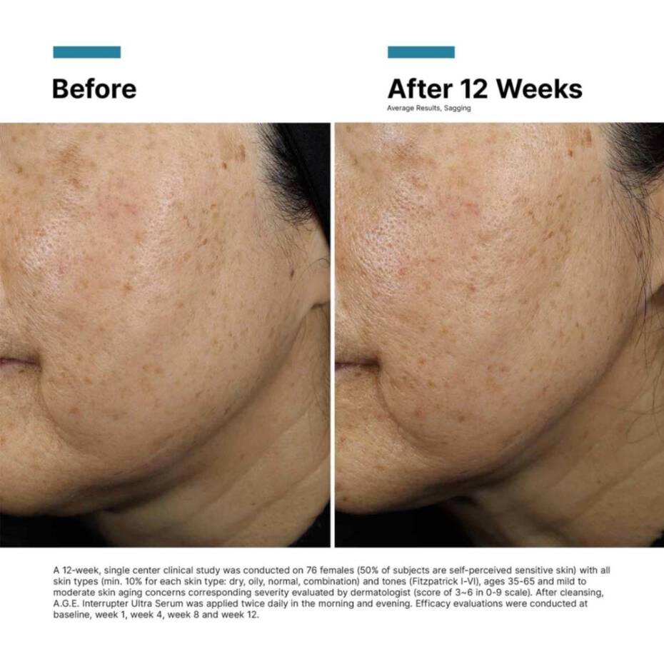 SKINCEUTICALS A.G.E. INTERRUPTER ULTRA SERUM