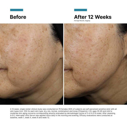 SKINCEUTICALS A.G.E. INTERRUPTER ULTRA SERUM